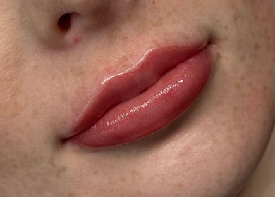 Glossy lip enhancement at KK Beauty, Bedfordshire, England, GB. Perfectly shaped, vibrant lips.