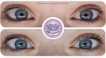 Lotus Embrace Beauty & Smile Studio ~ Richmond