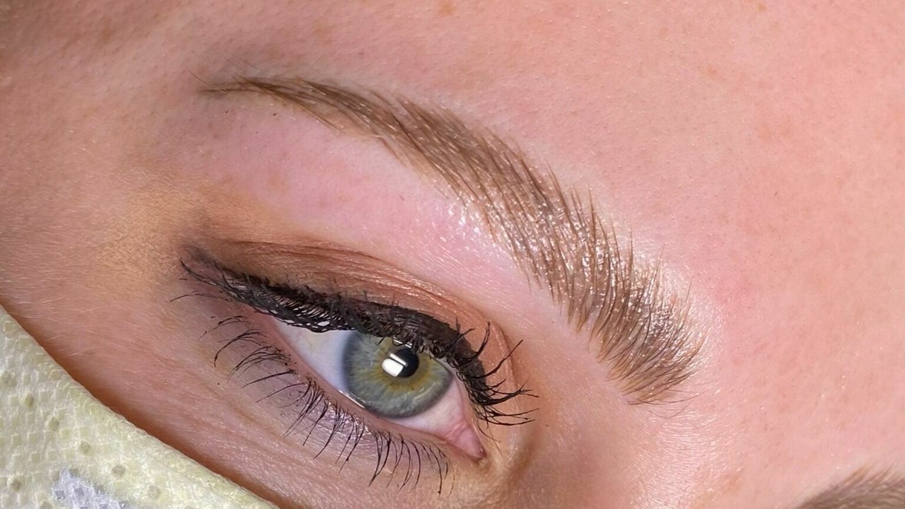 Another eyebrow transplant result of ours This patient had multiple  sessions of eyebrow tattooing and microblading prior to coming to us   Instagram