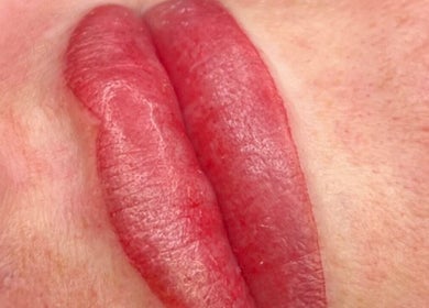 Close-up of enhanced lips post-treatment at Timeless Beauty Aesthetics, Emalahleni, Mpumalanga, ZA.