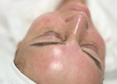 Close-up of a radiant face during facial treatment at Skin South Wales, Trethomas, Wales, GB.