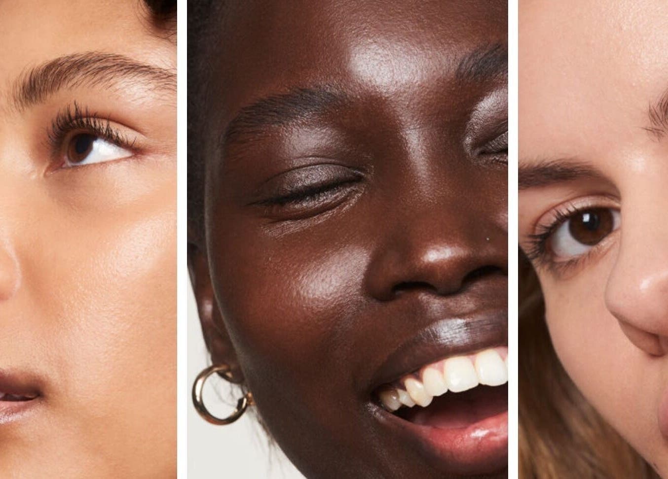 Diverse skin close-up at Skin Clinic by Kerry Courtney (Serenity Dental Spa Chorlton), Manchester, England, GB.