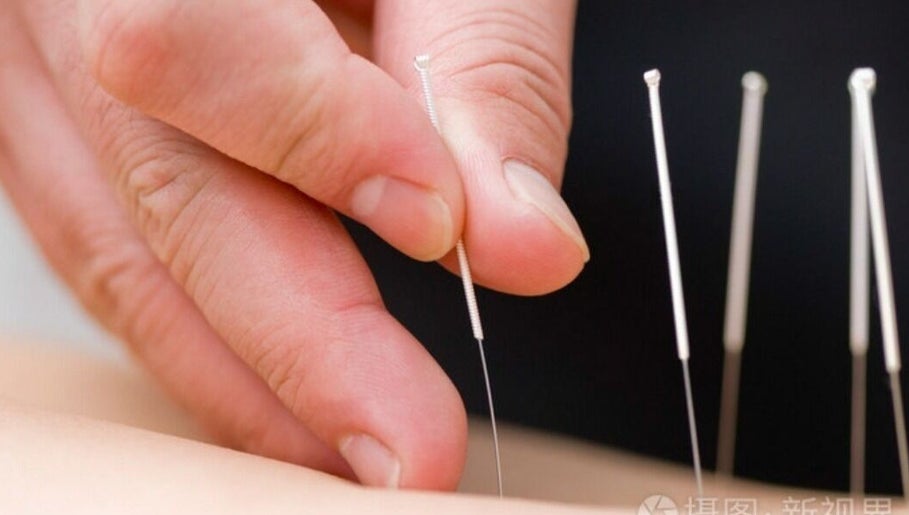 Imagen 1 de Yong Acupuncture