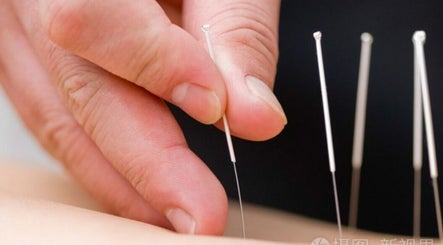 Yong Acupuncture