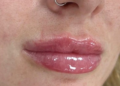 Close-up of glossy lips at Hair and Aesthetic Innovations MK, Milton Keynes, England, GB.