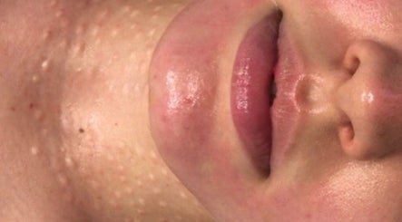 DermRefine Skin Clinic image 3