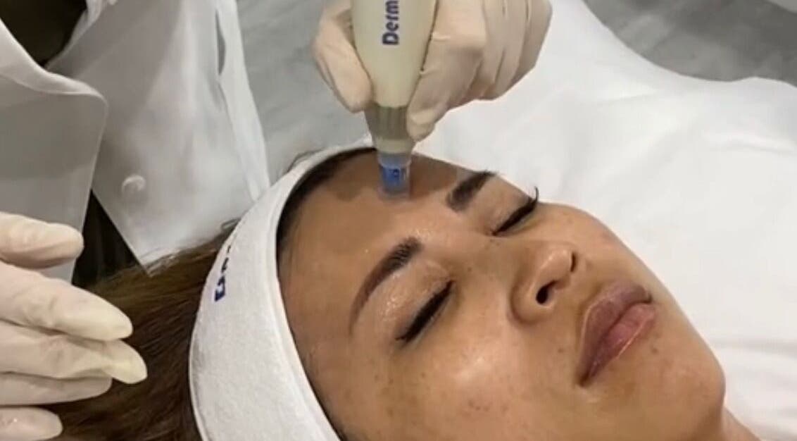 Facial treatment at DermRefine Skin Clinic, London, England, GB; enhancing facial glow and rejuvenation.