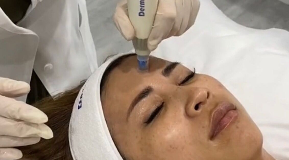 Facial treatment at DermRefine Skin Clinic, London, England, GB; enhancing facial glow and rejuvenation.