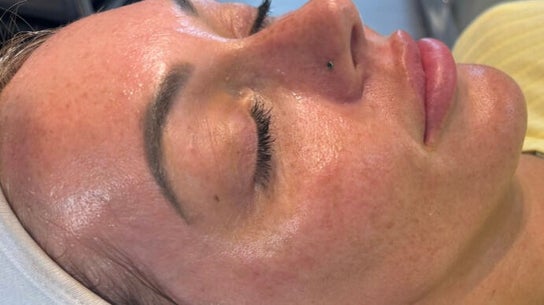 Regen Clinic Norwich 7
