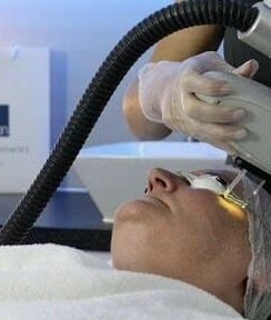 KMK Beauty | Aesthetics | Laser image 2