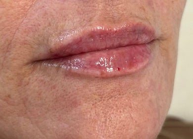 Close-up of enhanced lips at SC Aesthetics, Ayr, Scotland, GB showcasing a glossy finish.