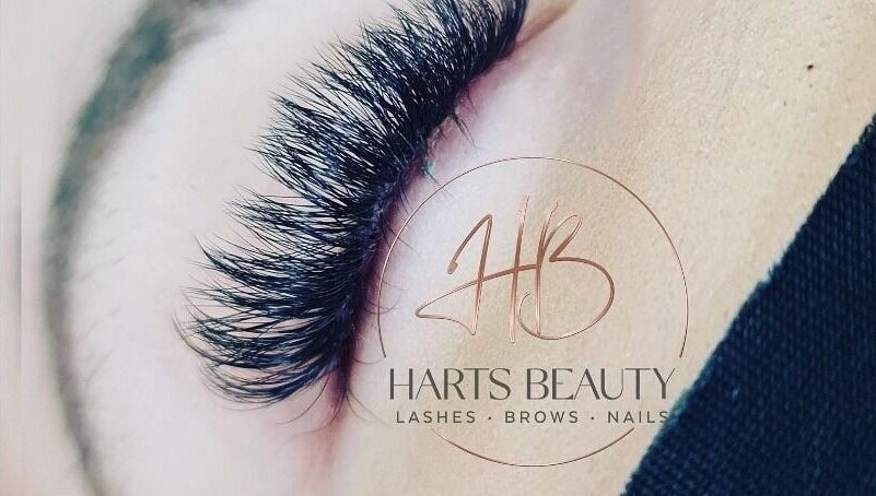 Harts Beauty – kuva 1