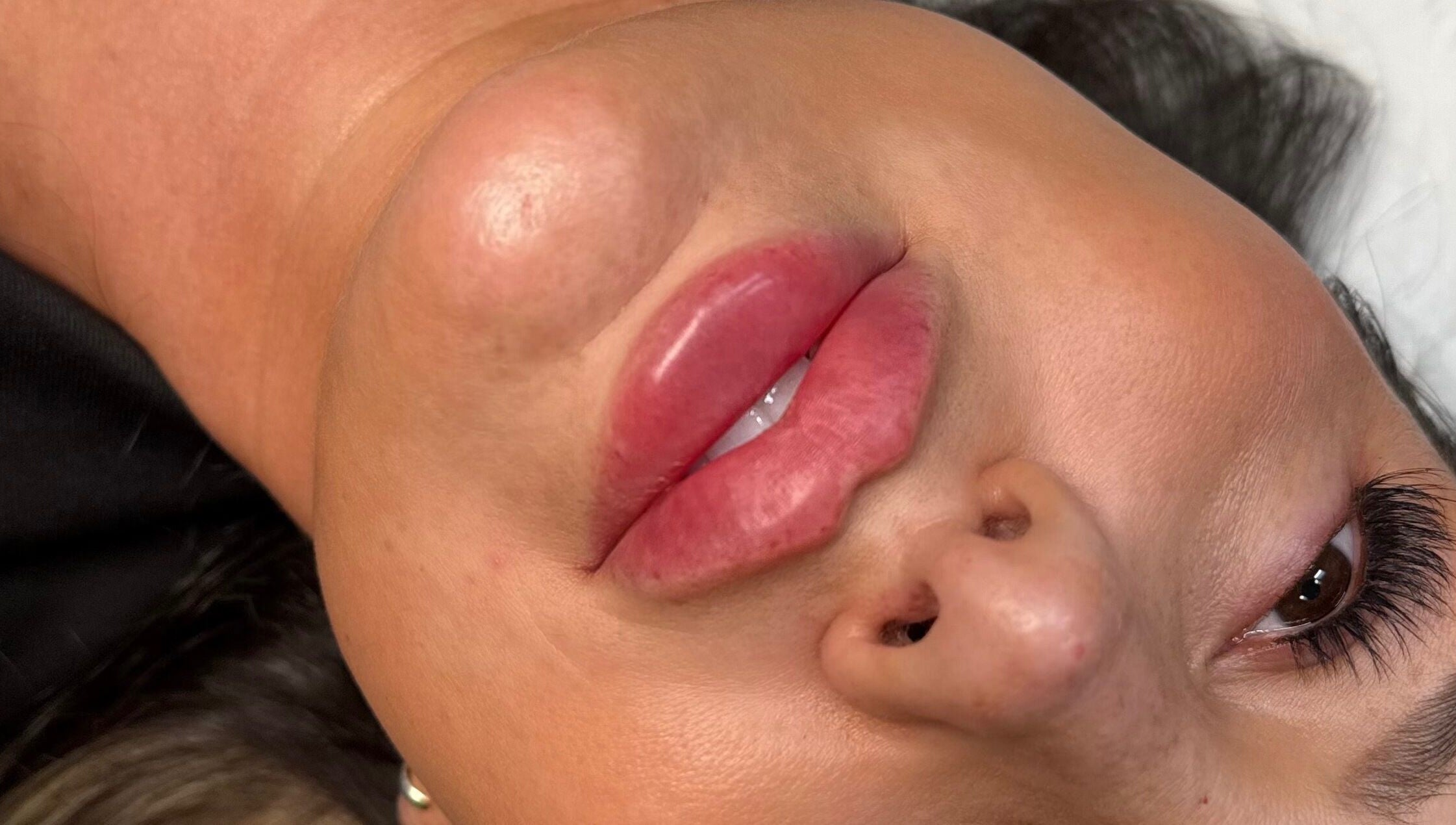 Close-up of enhanced lips at Profile by Leanne in Basingstoke, England, GB, showcasing beauty and wellness.