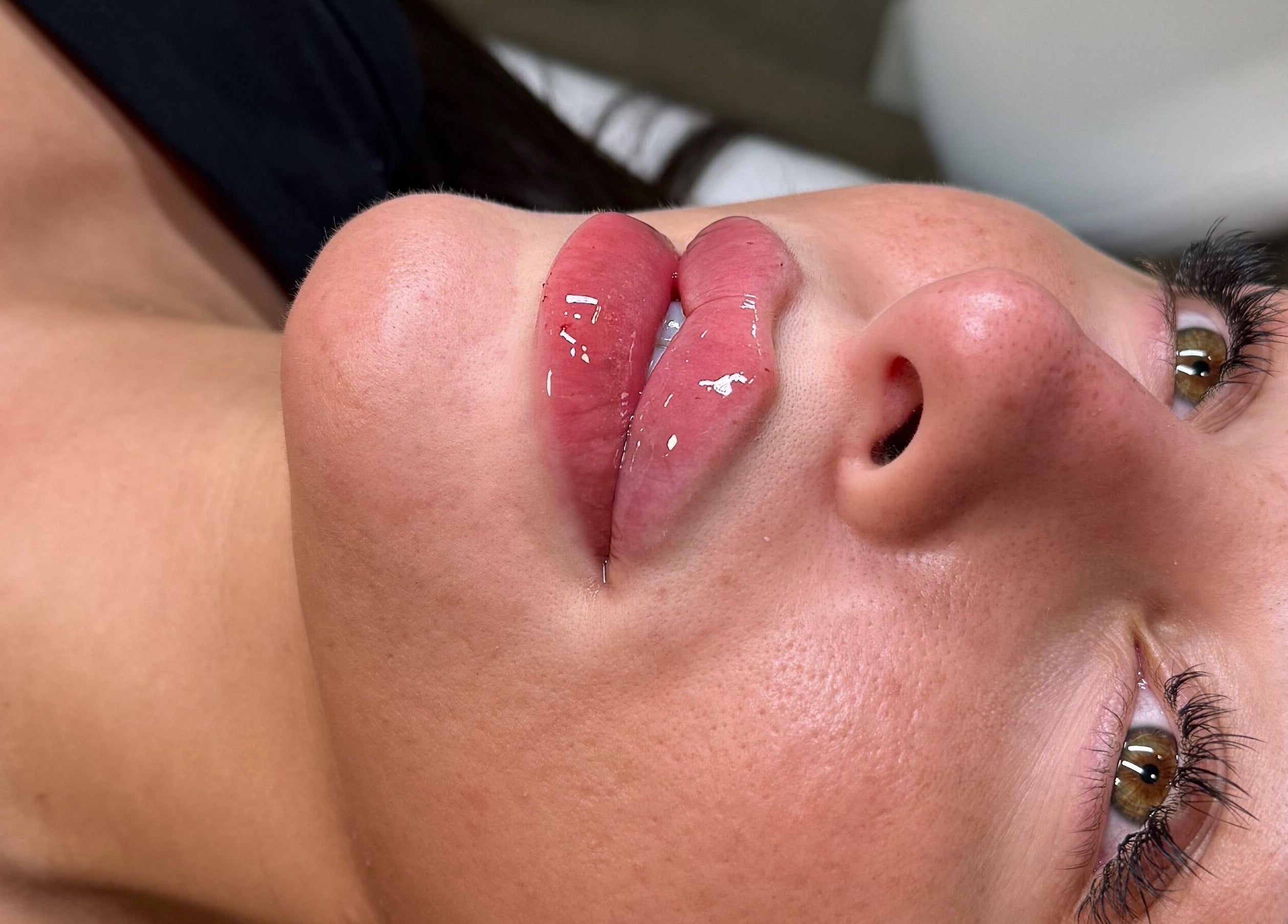 Glossy lip treatment at Profile by Leanne in Basingstoke, England, GB, showcasing a youthful and rejuvenated look.