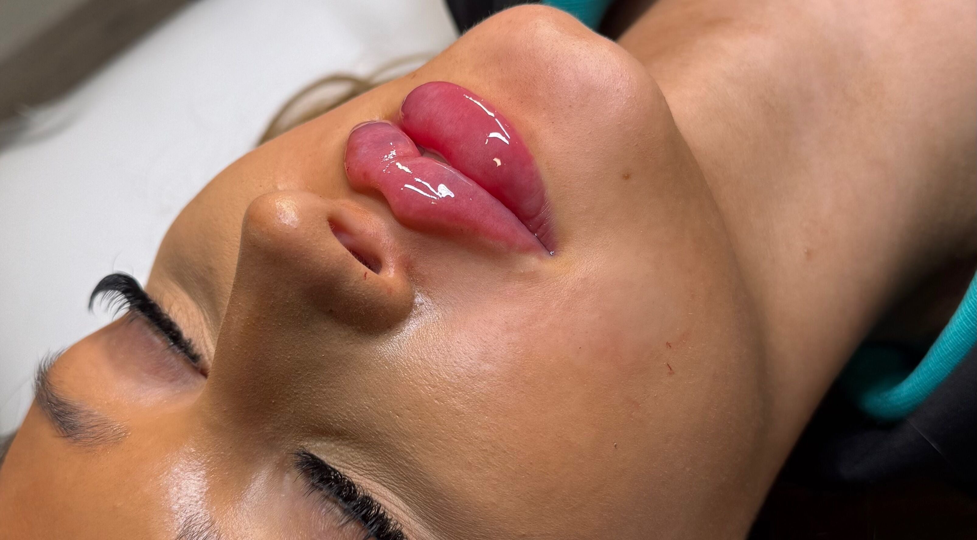 Close-up of glossy enhanced lips at Profile by Leanne, Basingstoke, England, GB.