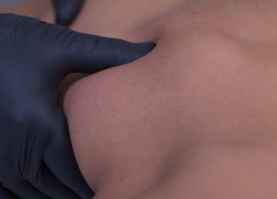 Close-up of therapeutic massage at Vesento Physiotherapy Limassol Gesy in Mesa Geitonia, Limassol, CY.