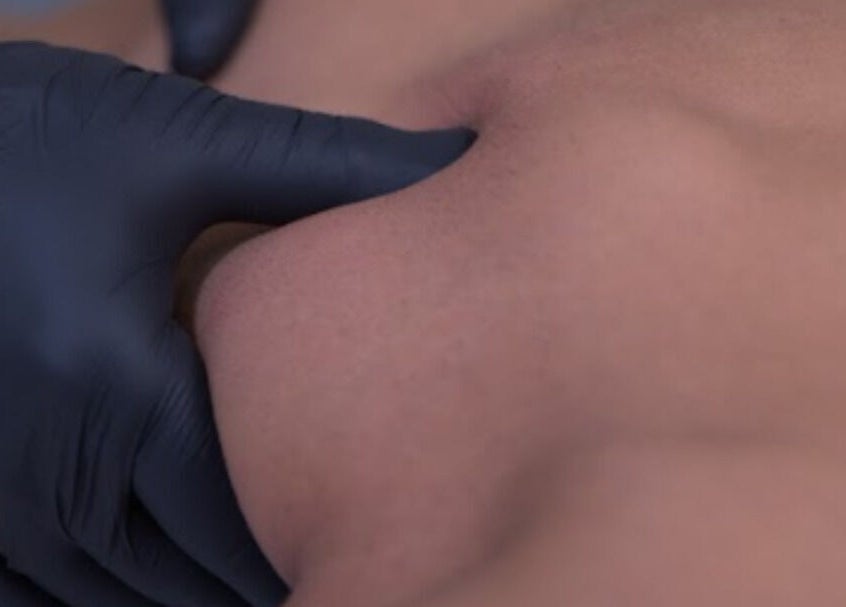 Close-up of massage therapy at Vesento Physiotherapy Limassol Gesy, Mesa Geitonia, Limassol, CY.