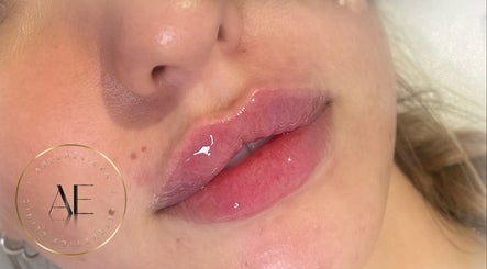 Close-up of glossy lips after treatment at AE Clinics - Abigael Eva (Sudbury), Sudbury, England, GB.