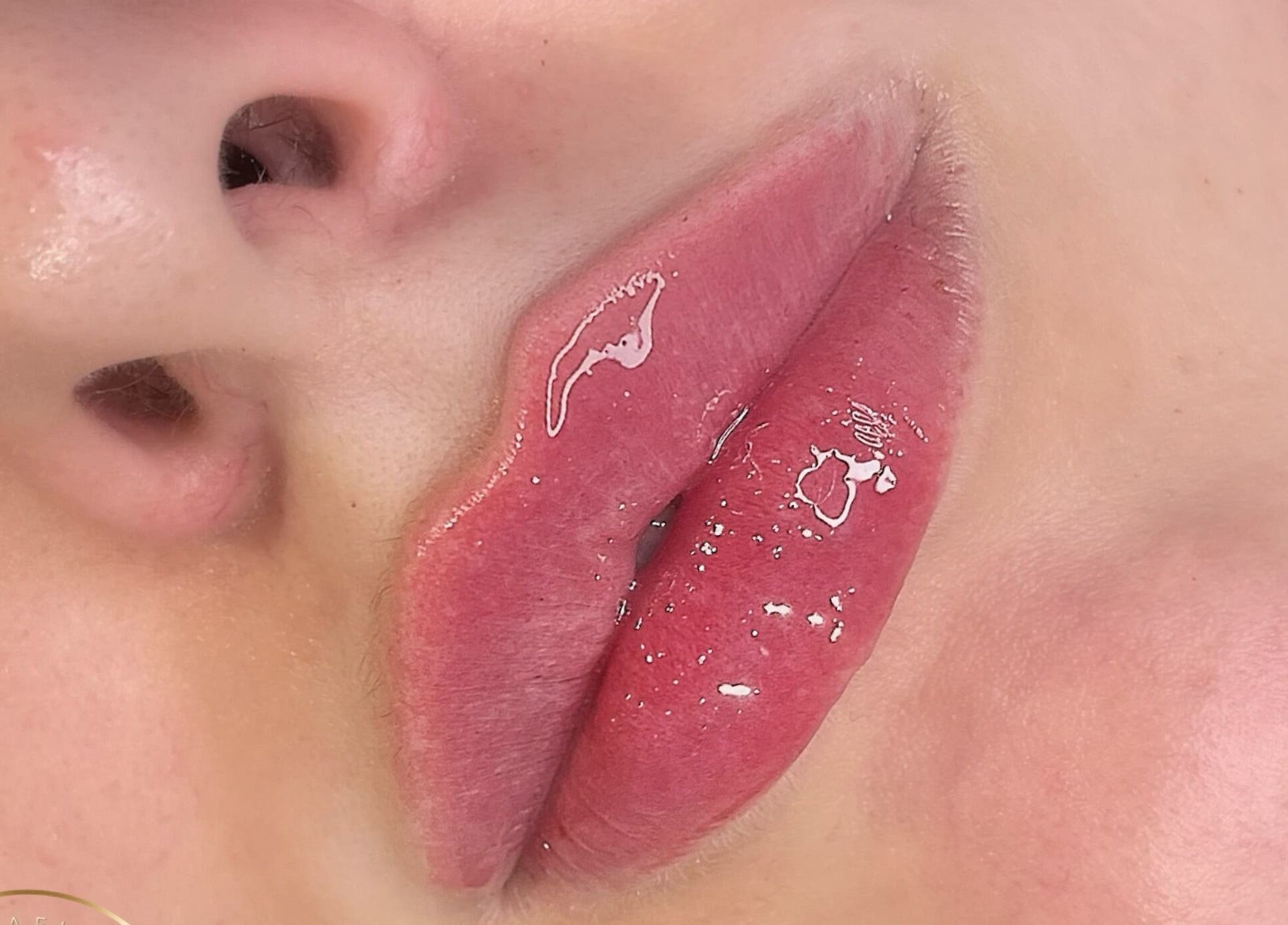 Close-up of glossy, enhanced lips at AE Clinics - Abigael Eva (Colchester) in Colchester, England, GB.