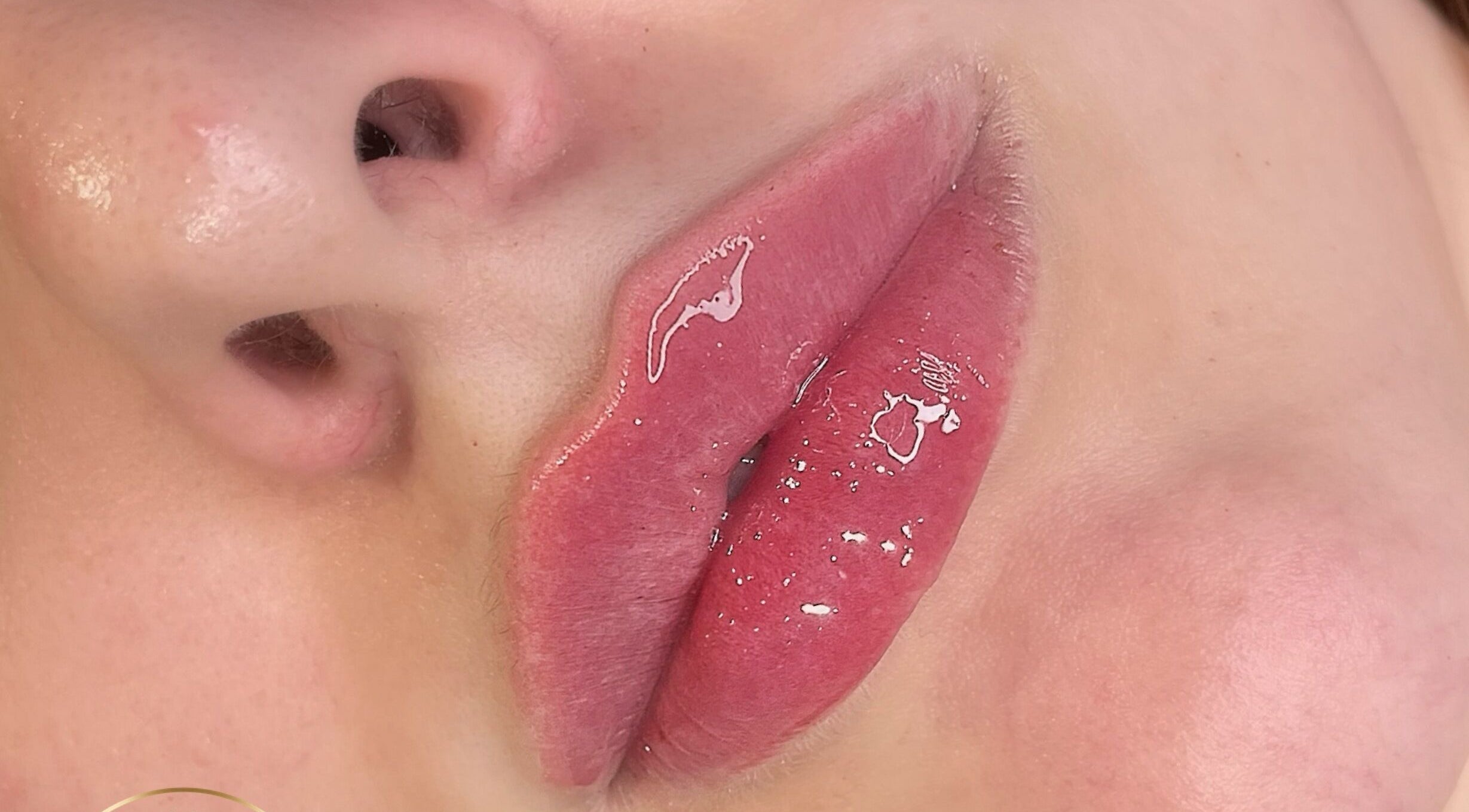 Close-up of glossy, enhanced lips at AE Clinics - Abigael Eva (Colchester) in Colchester, England, GB.