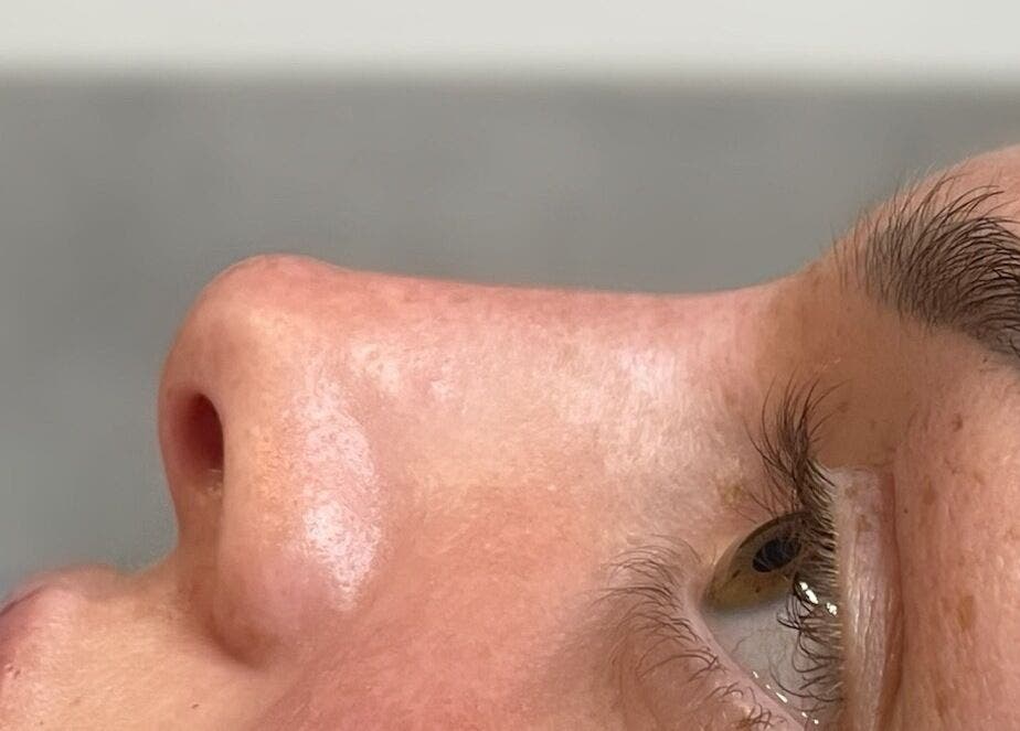 Close-up of a perfectly smooth and glowing skin at AE Clinics - Abigael Eva (Colchester), Colchester, England, GB.