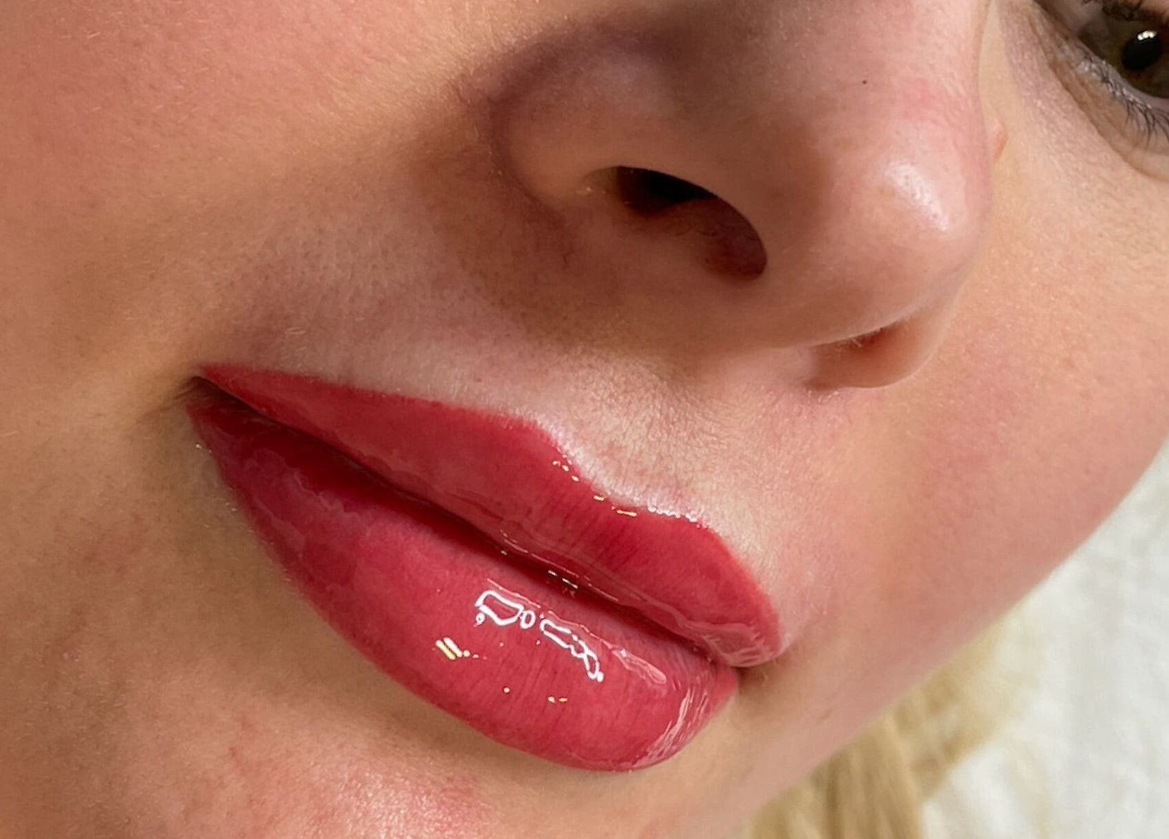 Close-up of glossy lips after treatment at AE Clinics - Abigael Eva, Colchester, England, GB.