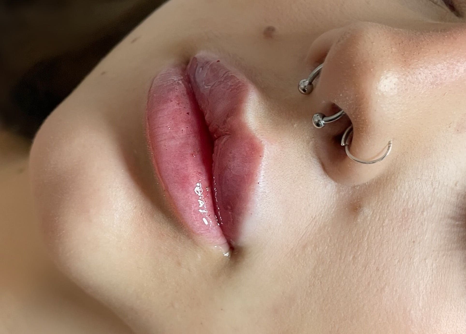 Close-up of adorned lips and nose at AE Clinics - Abigael Eva (Colchester), Colchester, England, GB.