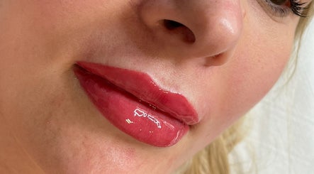Glossy, vibrant lips enhanced at AE Clinics - Abigael Eva (Bury St Edmunds), Bury St Edmunds, England, GB.