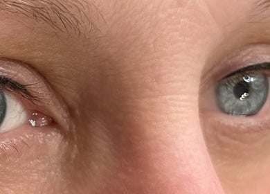Close-up of vibrant blue eyes at AE Clinics - Abigael Eva, Bury St Edmunds, England, GB.