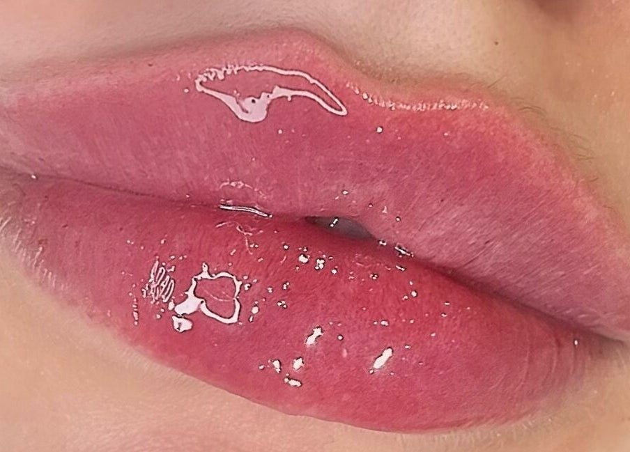 Close-up of glossy lips treatment at AE Clinics (Haverhill), Haverhill, England, GB.