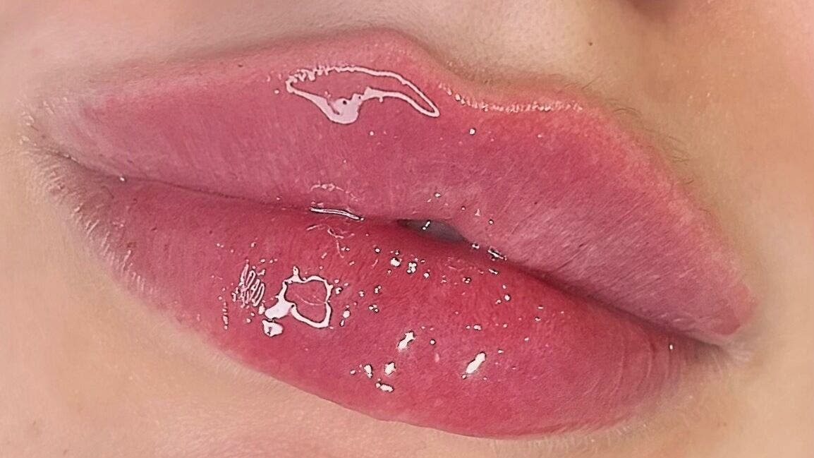 Close-up of glossy pink lips, showcasing beauty treatment at AE Clinics (Sudbury), Sudbury, England, GB.