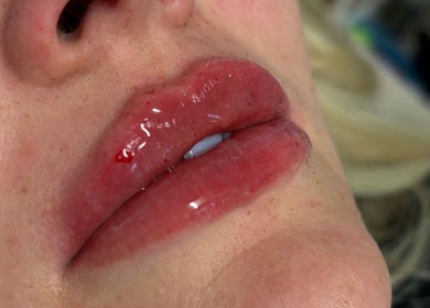 Close-up of glossy lips after treatment at Lulah Lashes & Beauty, Blyth, England, GB.