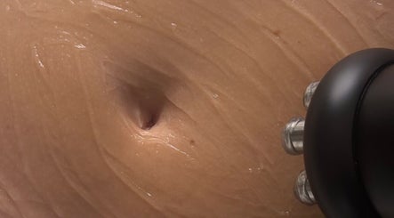 Radiofrequency device on skin at Sculpt and Shape Kent Skin & Body Clinic, Kings Hill, England, GB.