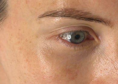 Close-up of healthy skin showcased at Sculpt and Shape Kent Skin & Body Clinic, Kings Hill, England, GB.