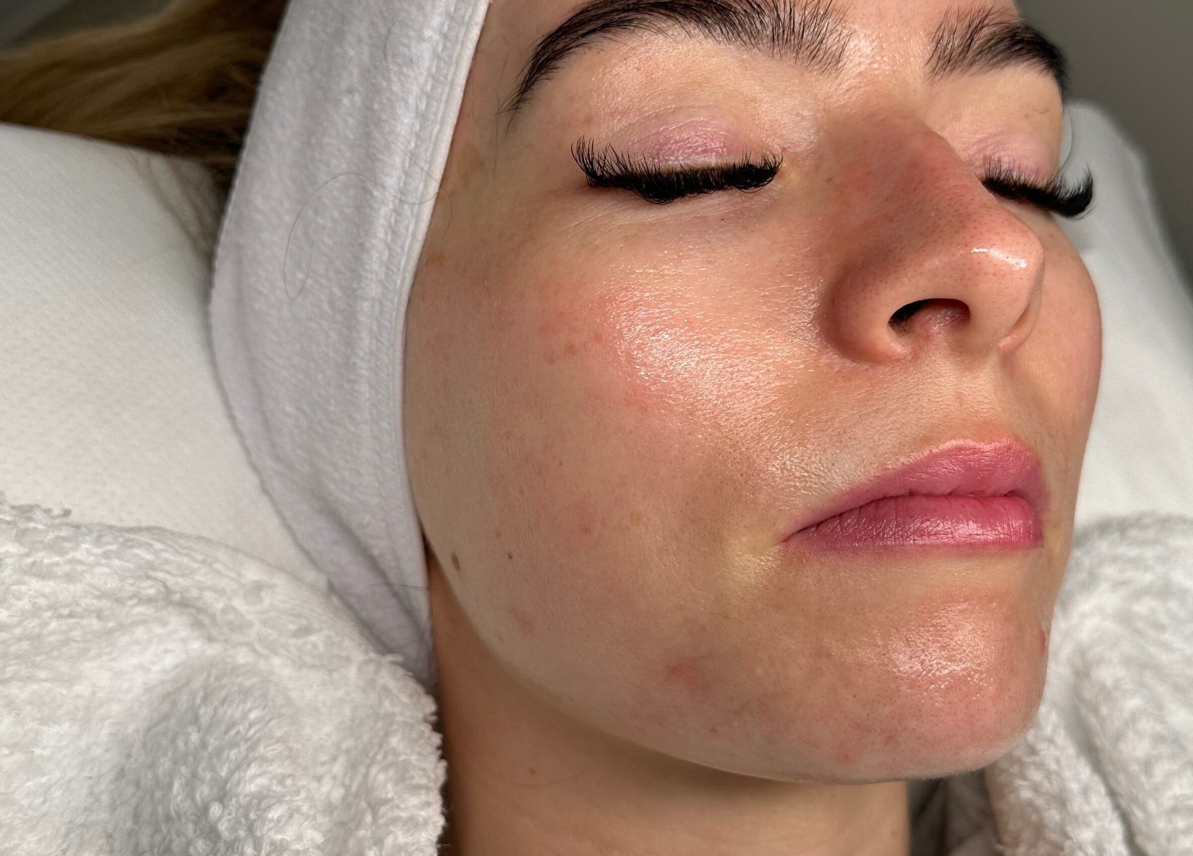 Relaxed woman receiving facial treatment at Sculpt and Shape Kent Skin & Body Clinic in Kings Hill, England, GB.