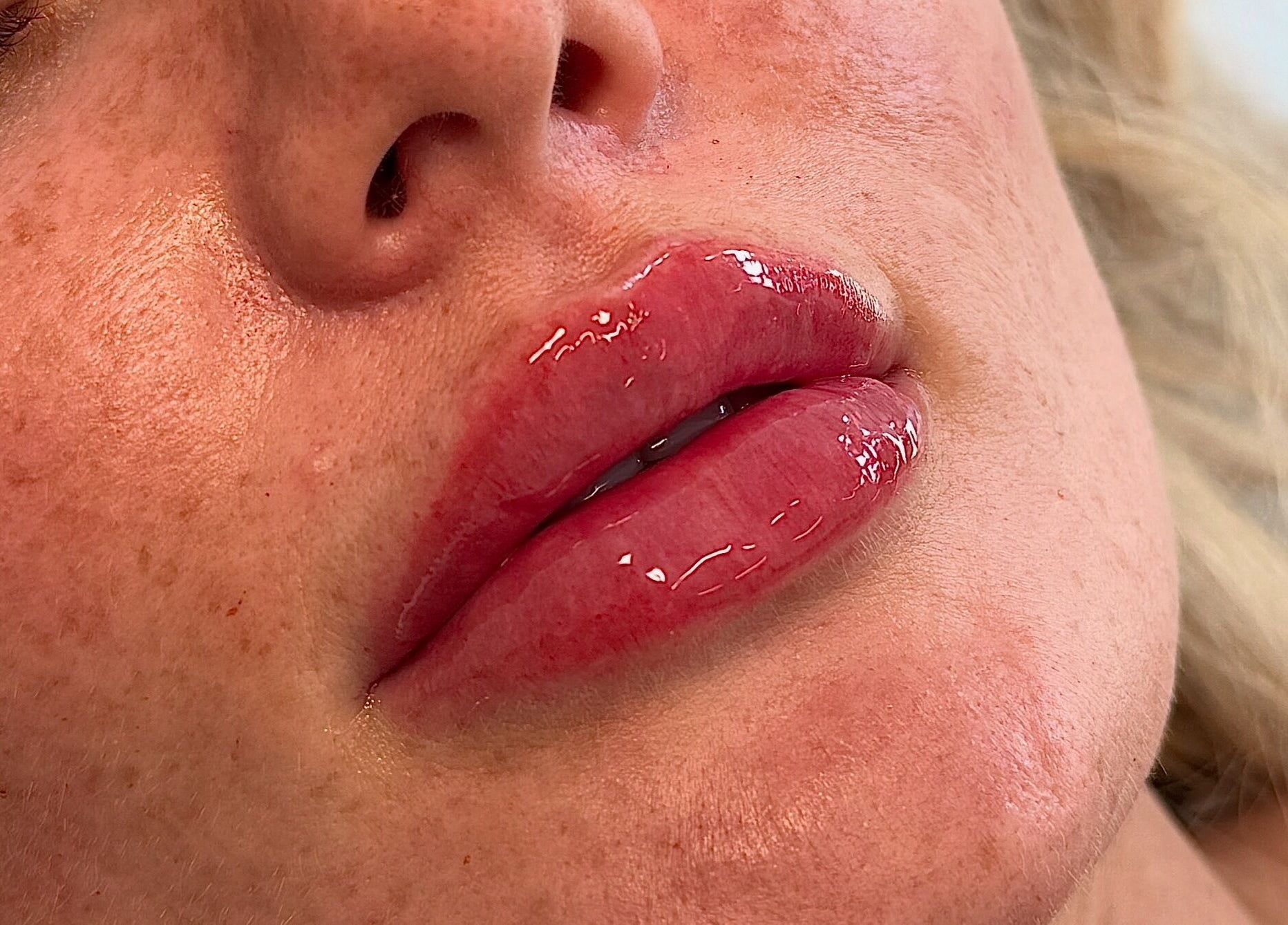 Close-up of glossy lips at ASTHTX Clinic, Motherwell, Scotland, GB showcasing beauty treatments.