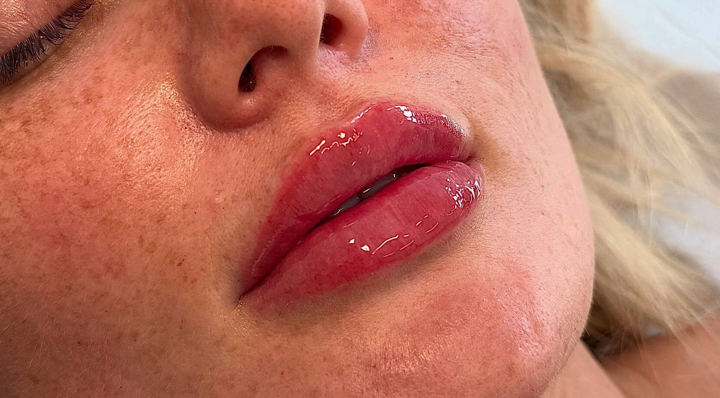 Close-up of glossy lips at ASTHTX Clinic, Motherwell, Scotland, GB showcasing beauty treatments.