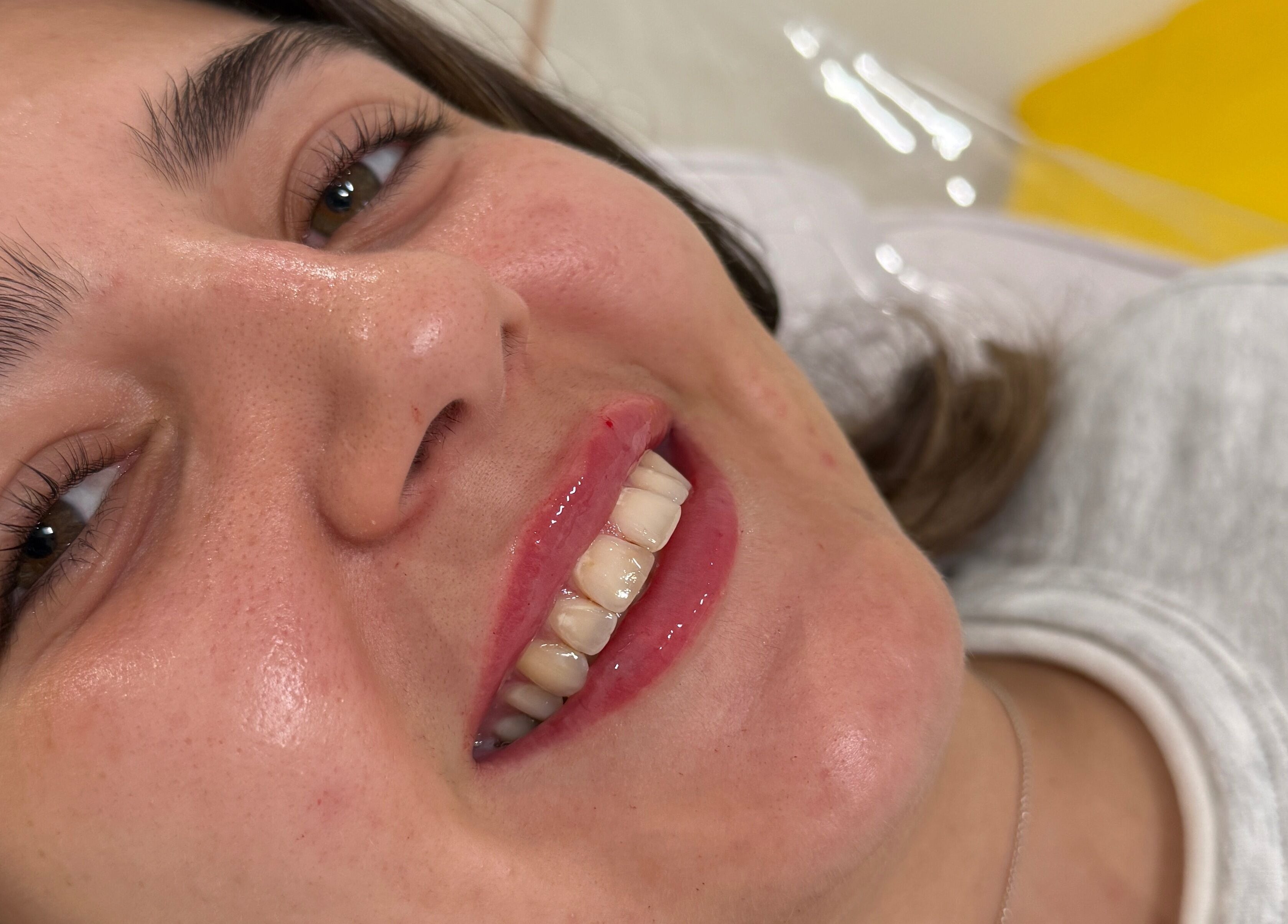 Smiling client after treatment at ASTHTX Clinic, Motherwell, Scotland, GB. Experience radiant skincare results.