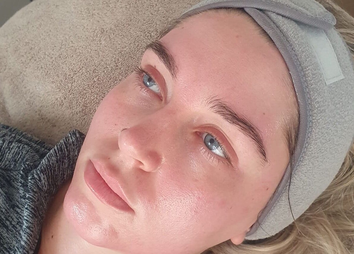 Client experiencing facial treatment at Skin Revision, Douglas, IM, showcasing smooth, rejuvenated skin.