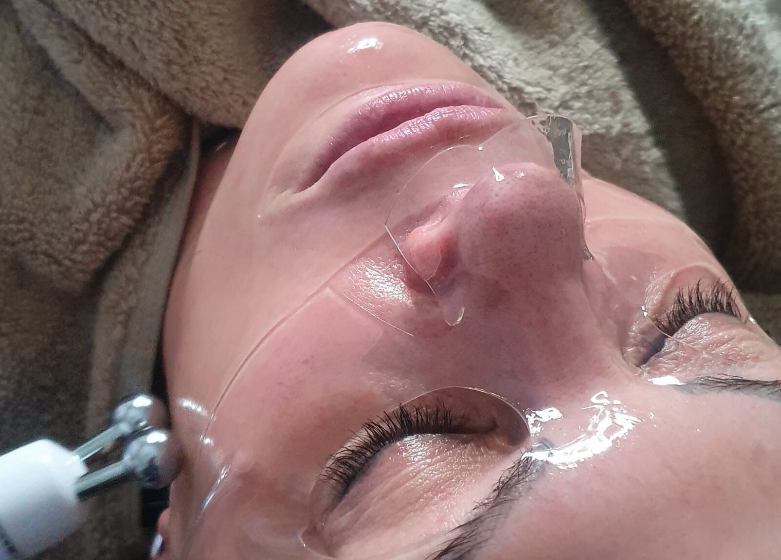 Facial treatment at Skin Revision, Douglas, IM, showcasing a rejuvenating skincare process.