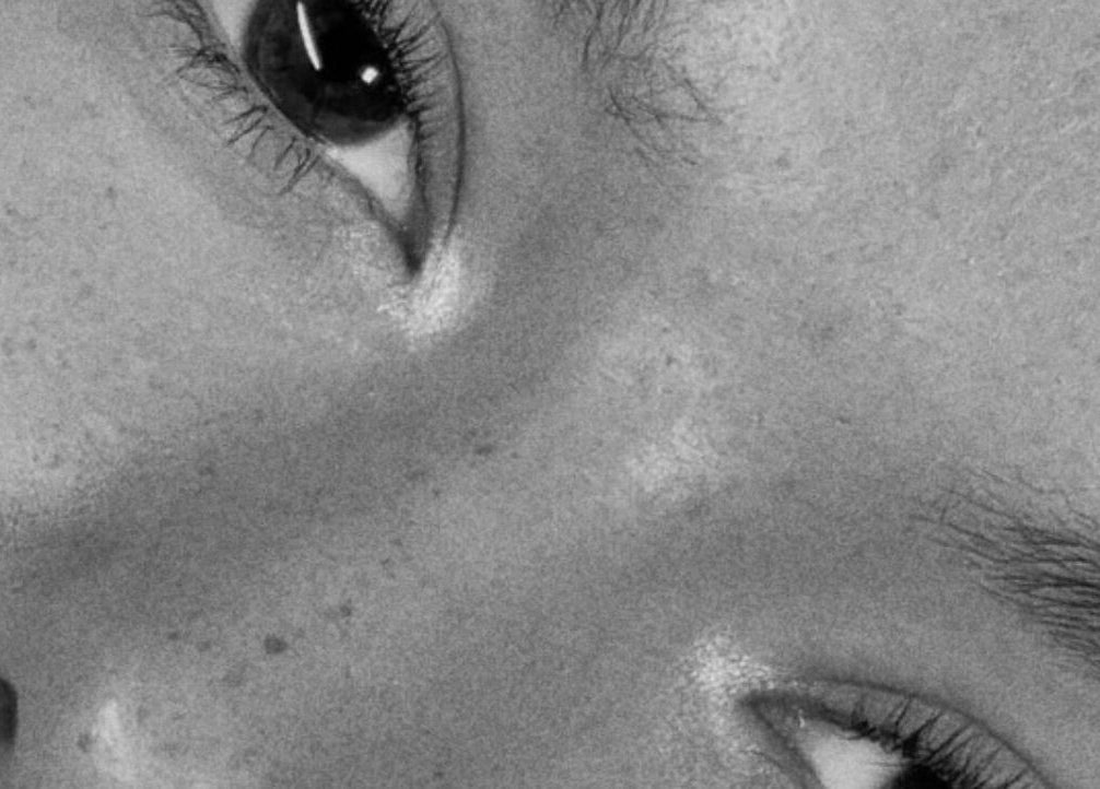 Close-up of eyes showing skincare expertise at Aura Aesthetics Studio, Cessnock, AU.