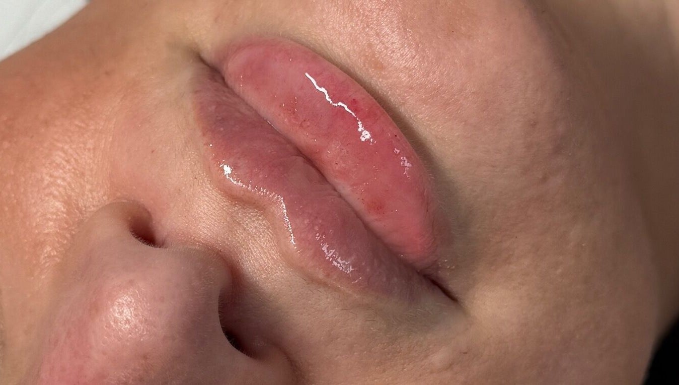 Closeup of glossy lips after treatment at AJ Aesthetics Lounge, Paddock Wood, England, GB.
