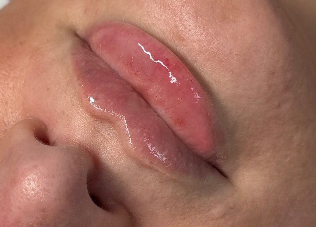 Closeup of glossy lips after treatment at AJ Aesthetics Lounge, Paddock Wood, England, GB.