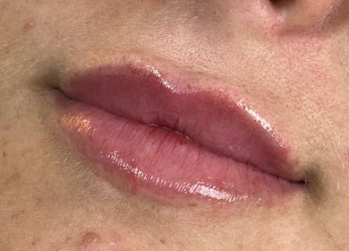 Close-up of glossy lips treated at AJ Aesthetics Lounge, Paddock Wood, England, GB for a natural enhancement.