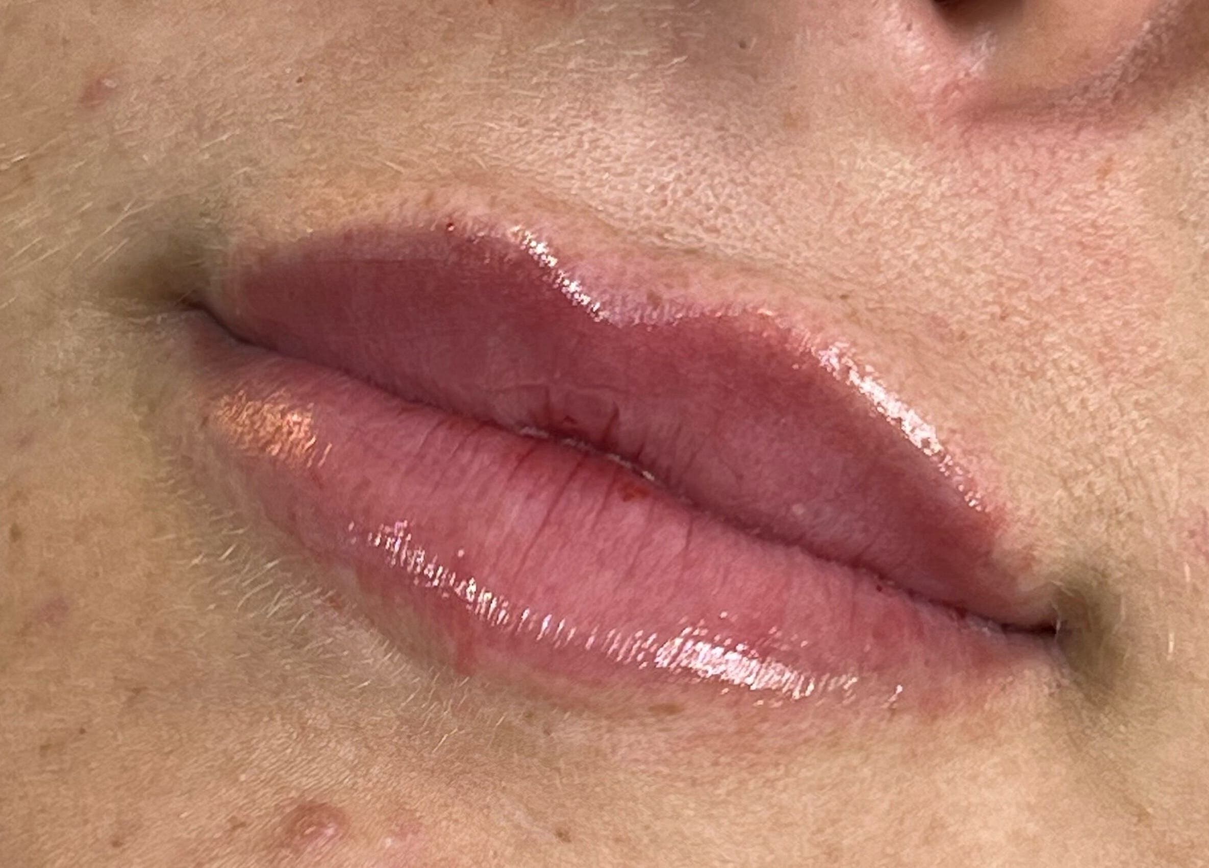 Close-up of glossy lips treated at AJ Aesthetics Lounge, Paddock Wood, England, GB for a natural enhancement.