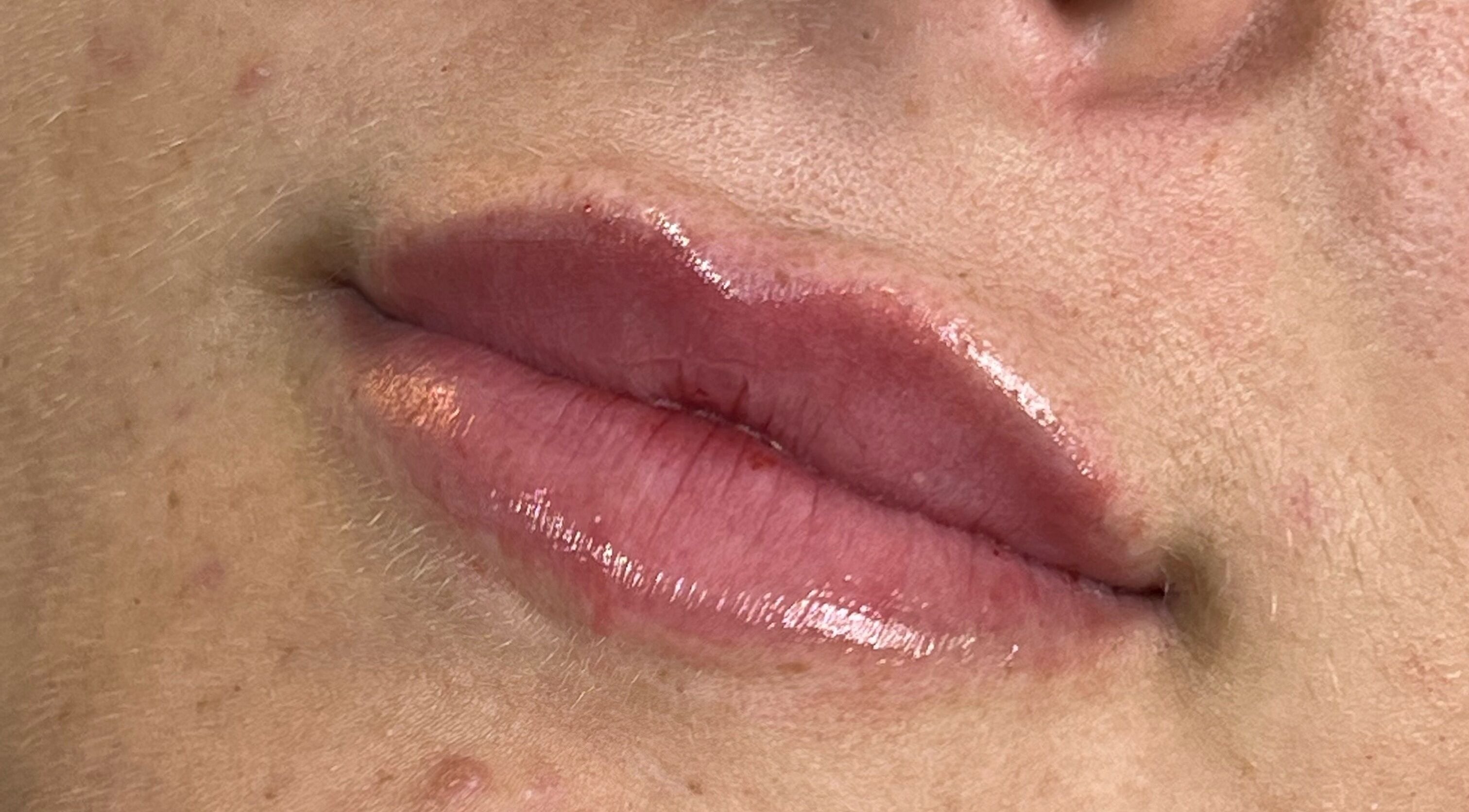 Close-up of glossy lips treated at AJ Aesthetics Lounge, Paddock Wood, England, GB for a natural enhancement.