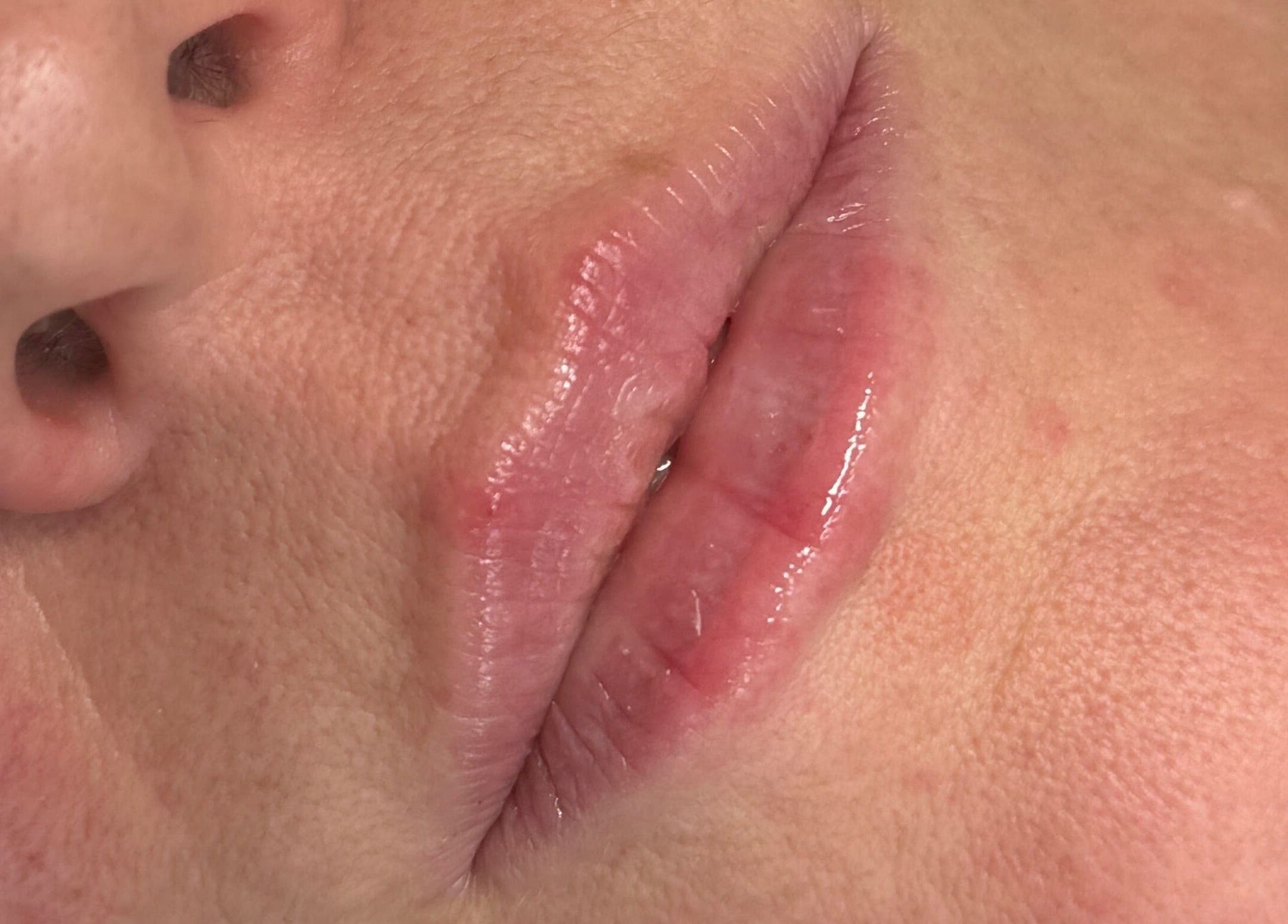 Close-up of glossy lips treatment at AJ Aesthetics Lounge, Paddock Wood, England, GB.