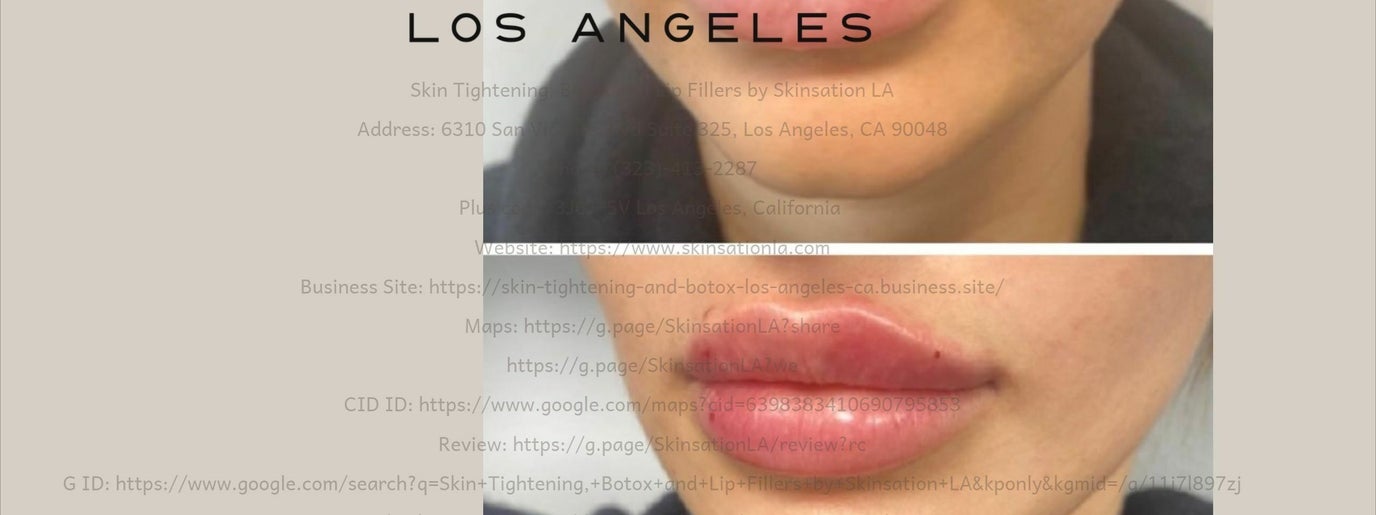 Some Known Factual Statements About Skin Tightening, Botox And Lip Fillers By Skinsation La  thumbnail