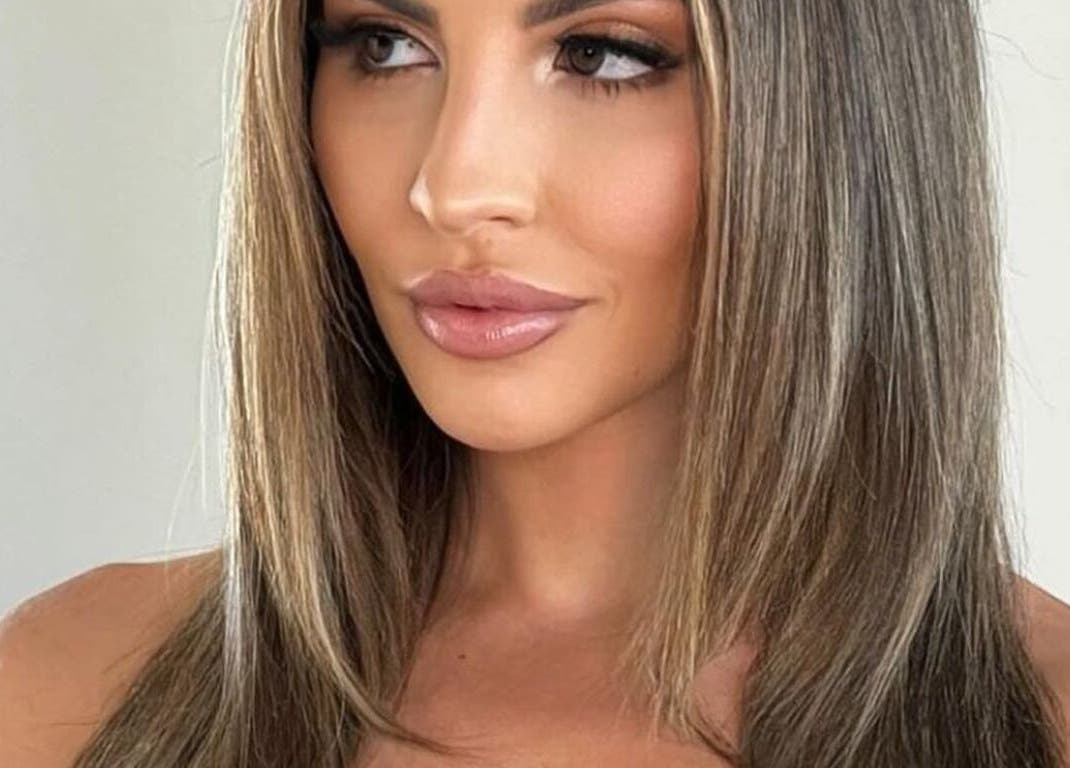 Glamorous woman radiating beauty, showcasing results from Skinsation LA in Los Angeles, California, US.