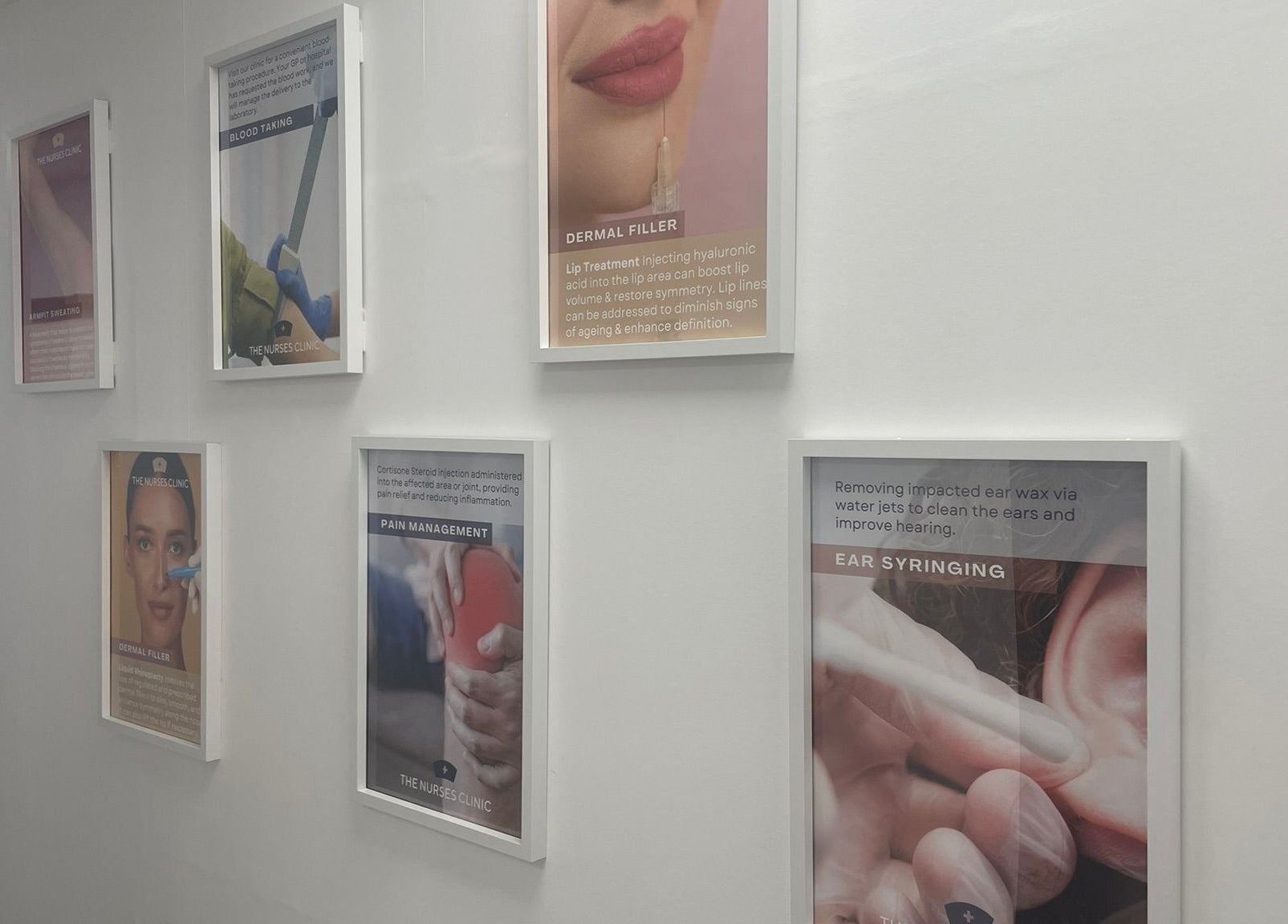 Promotional posters at The Nurses Clinic, Nuneaton showcase diverse beauty and wellness services, Nuneaton, England, GB.